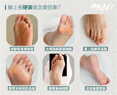 腳背厚面相|「腳相」算命：你的腳屬於什麼命？